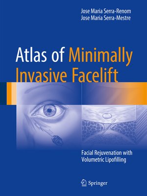cover image of Atlas of Minimally Invasive Facelift